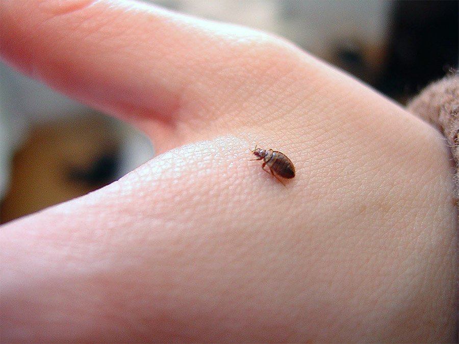 How Long Can Scabies Live in a Mattress? 1 how-long-can-scabies-live-in-a-mattress